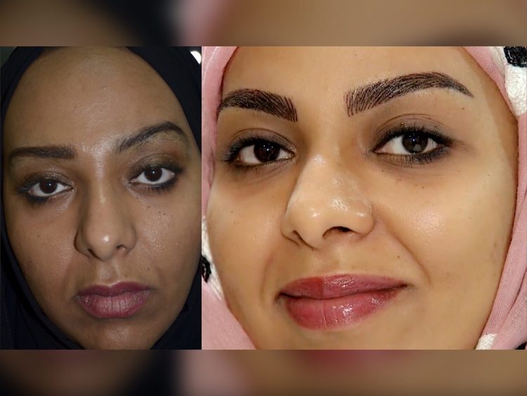 Ghada Sharfi Beauty Mask Professional Treatment